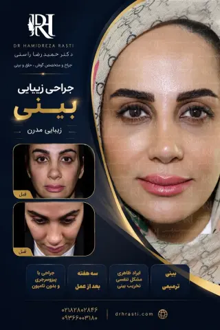 نمونه کار واقعی جراحی بینی دکتر حمیدرضا راستی - قبل و بعد
