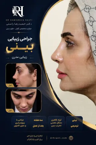 نمونه کار واقعی جراحی بینی دکتر حمیدرضا راستی - قبل و بعد