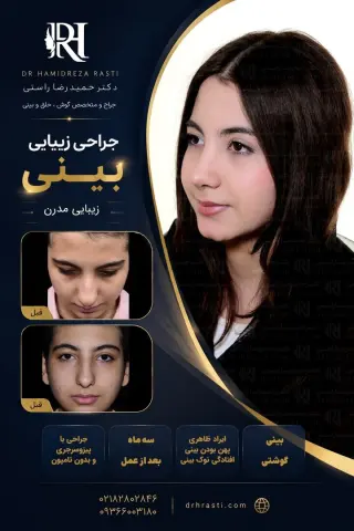 نمونه کار واقعی جراحی بینی دکتر حمیدرضا راستی - قبل و بعد