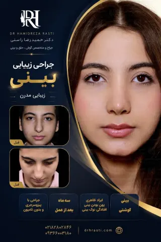 نمونه کار واقعی جراحی بینی دکتر حمیدرضا راستی - قبل و بعد