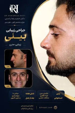 نمونه کار واقعی جراحی بینی دکتر حمیدرضا راستی - قبل و بعد