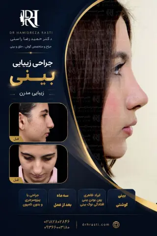 نمونه کار واقعی جراحی بینی دکتر حمیدرضا راستی - قبل و بعد