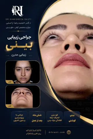 نمونه کار واقعی جراحی بینی دکتر حمیدرضا راستی - قبل و بعد