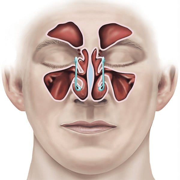 Diseases of the Nasal Mucosa – 2 Important Conditions