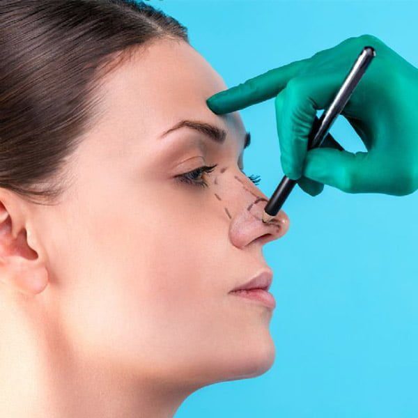 هزینه عمل انحراف بینی