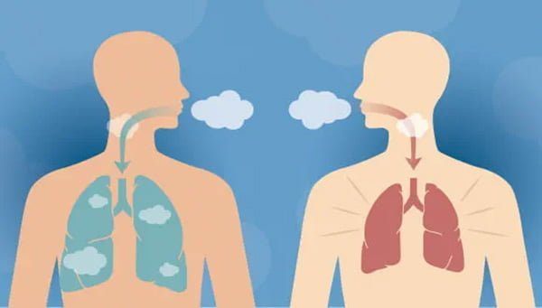 تنگی نفس و علائم آن