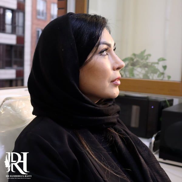 بهترین جراح بینی استخوانی در تهران