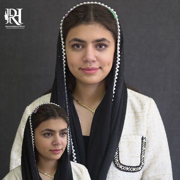 عمل بینی زنانه