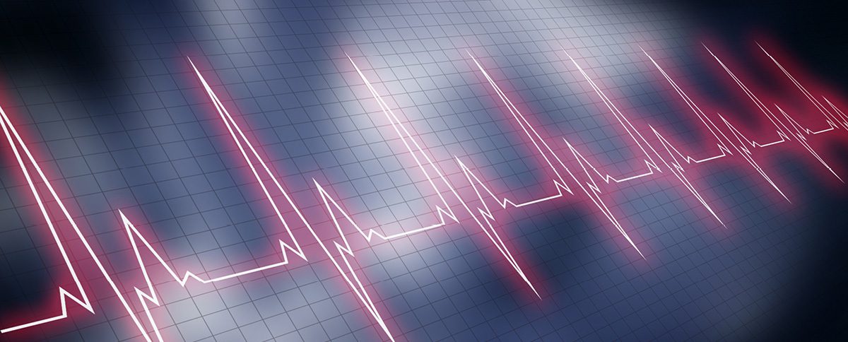 سندرم سینوس بیمار و تأثیرات آن بر قلب