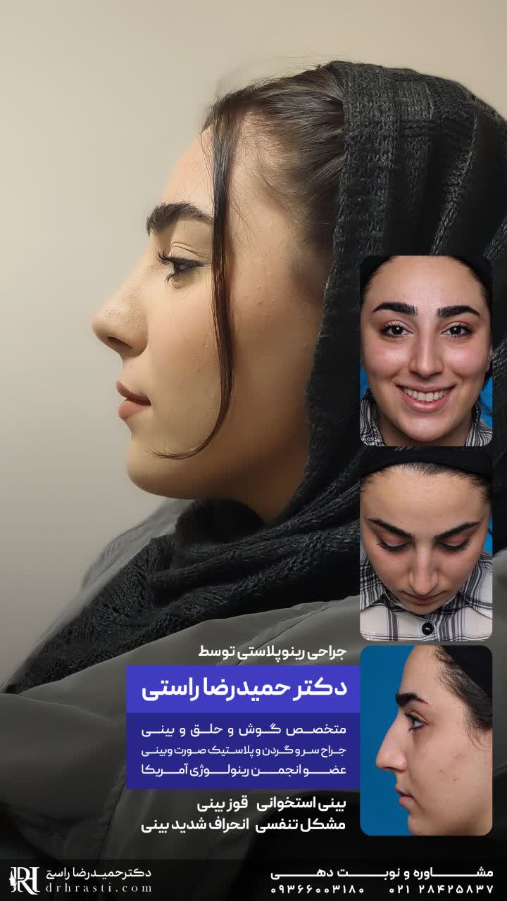 عمل بینی گوشتی