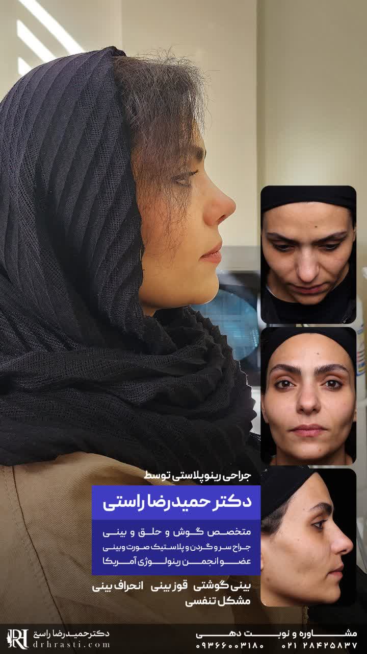 عکس بینی فانتزی و نیمه فانتزی