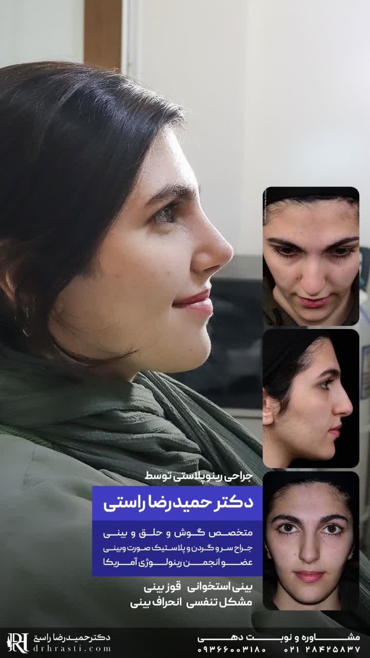عکس بینی فانتزی و نیمه فانتزی