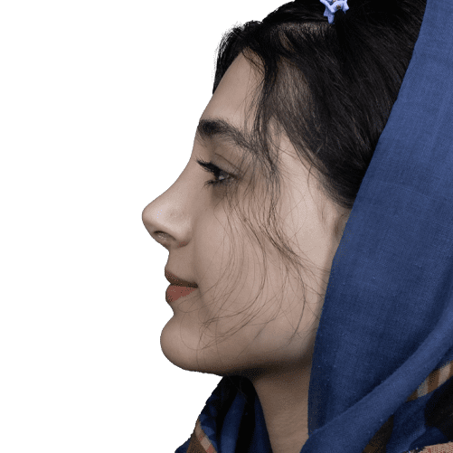بینی نیمه فانتزی