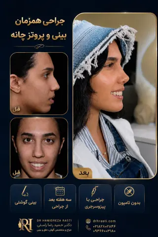 قبل و بعد جراحی هم‌زمان بینی و پروتز چانه