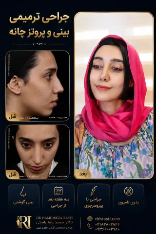قبل و بعد جراحی ترمیمی بینی و پروتز چانه