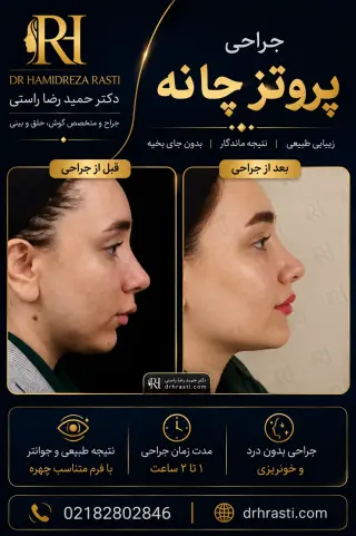 قبل و بعد جراحی پروتز چانه
