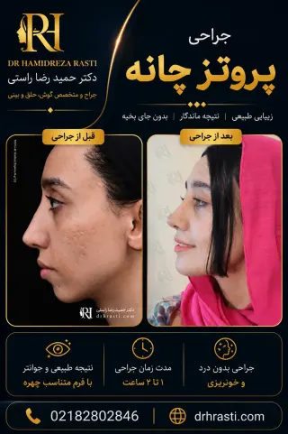 قبل و بعد پروتز چانه با نتیجه طبیعی